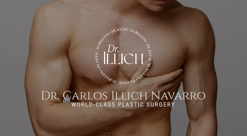 Dr. Carlos Illich Navarro board certified plastic surgeon offers gynecomastia surgery